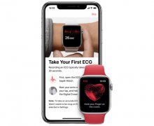 Apple Watch s podporou EKG už aj na Slovensku!
